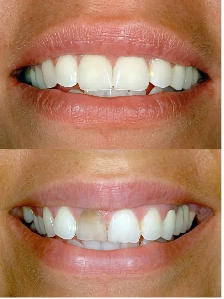 Before and After