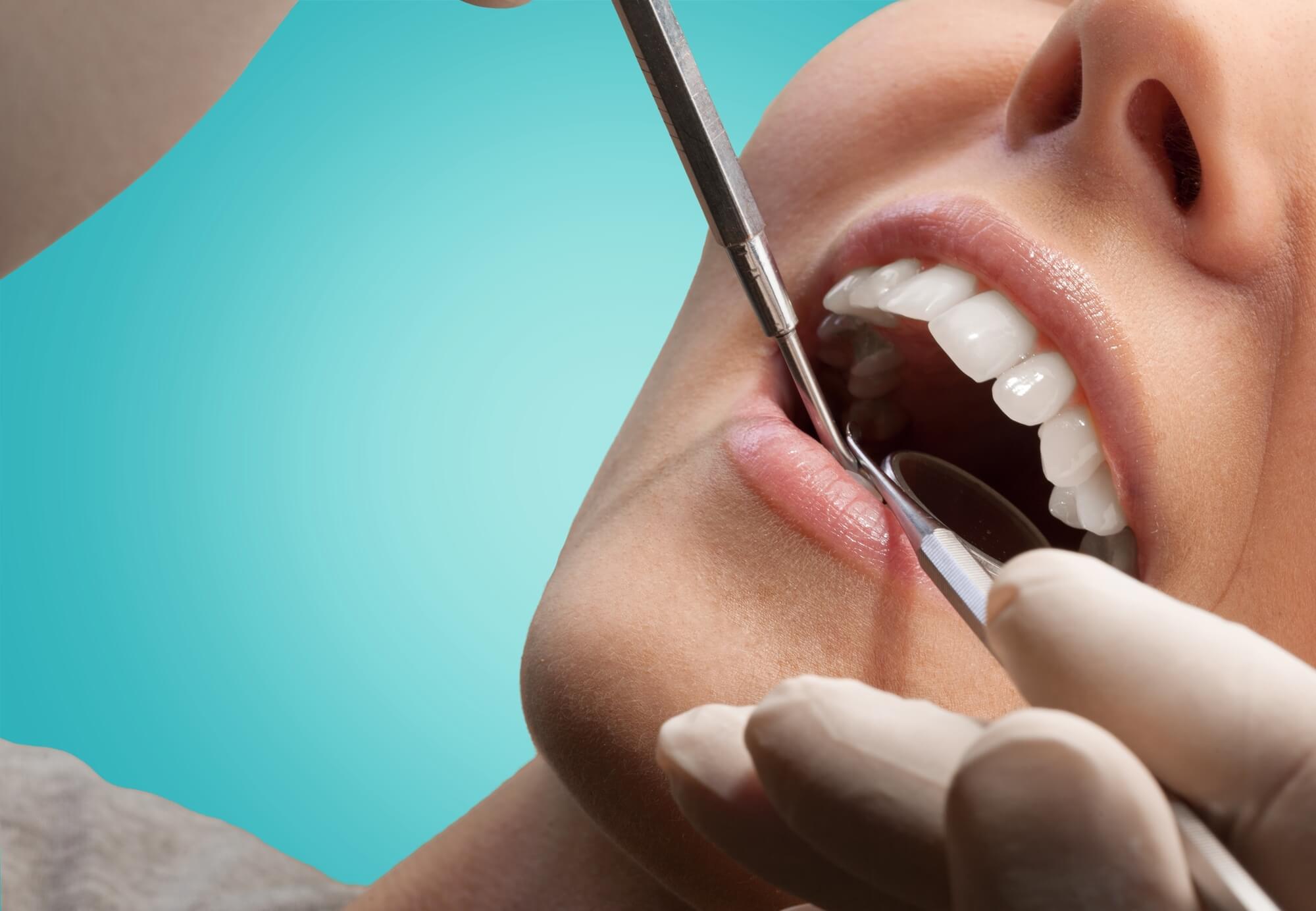 who offers dental crowns fort pierce?