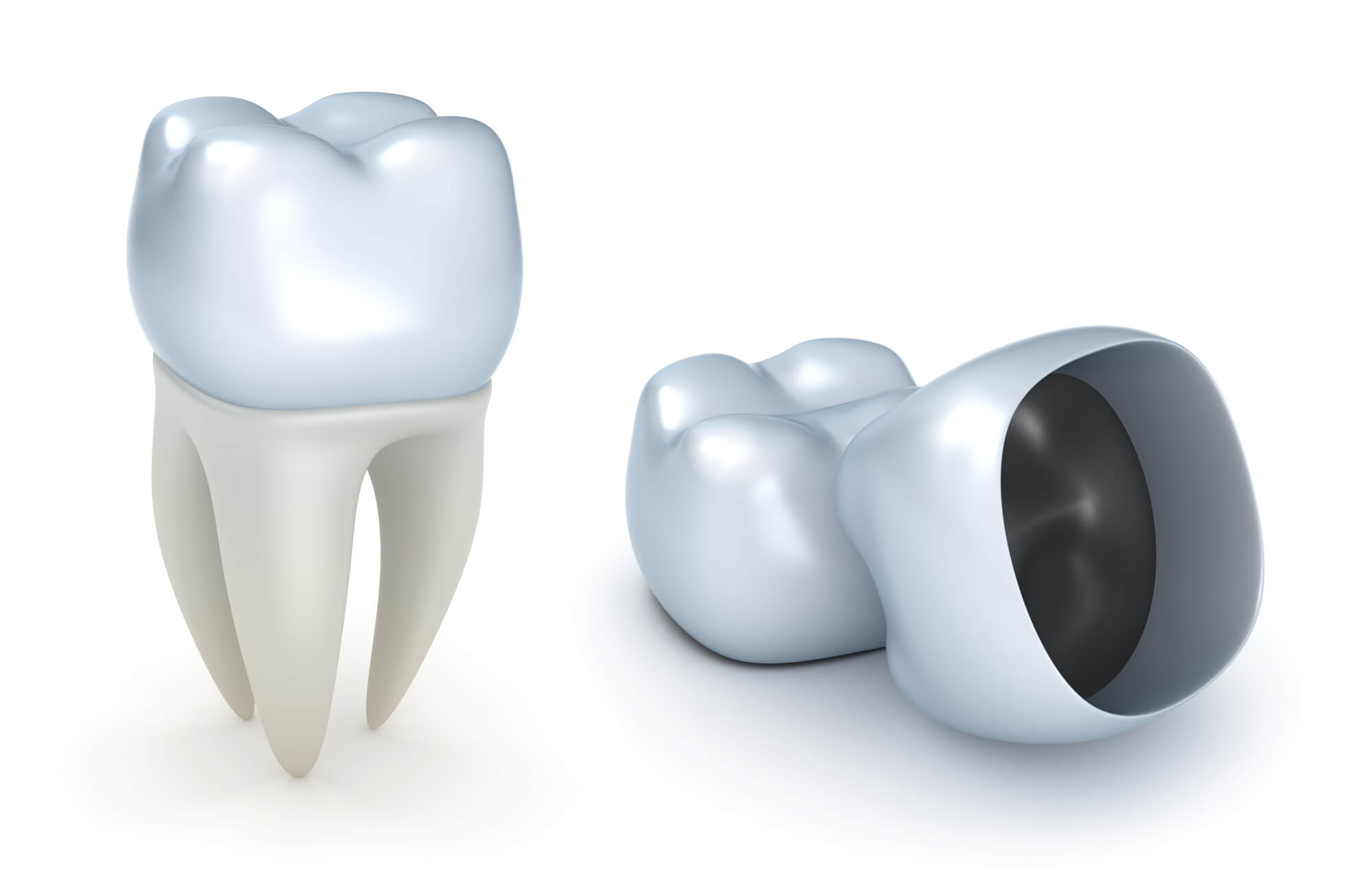 hollow shaped Dental Crowns in Fort Pierce