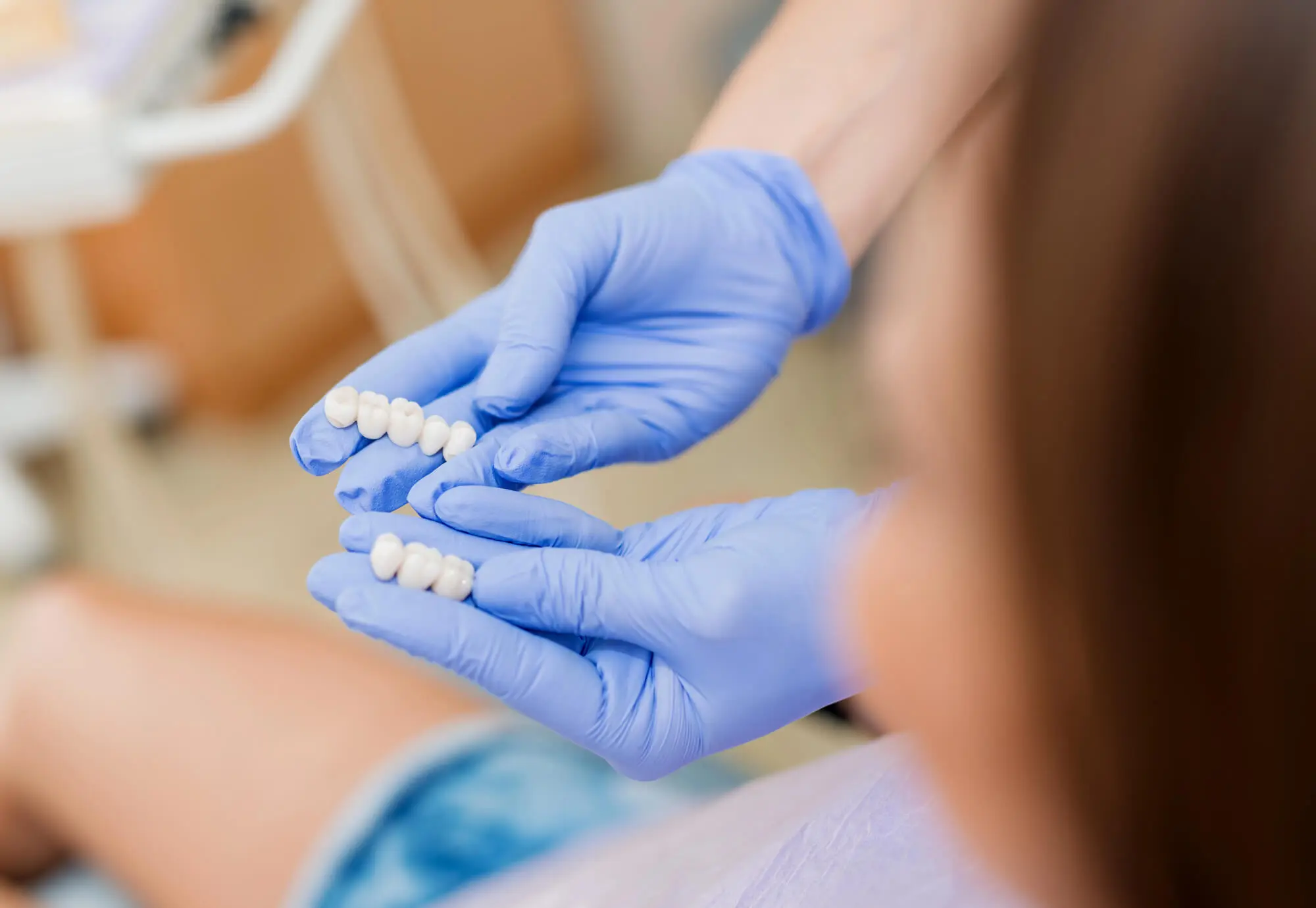 Cosmetic Dental Crowns in Fort Piece