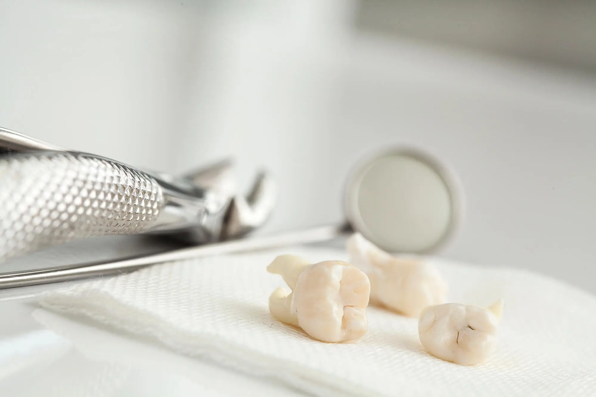 Dentist in Fort Piece Explains Hard Teeth Extractions