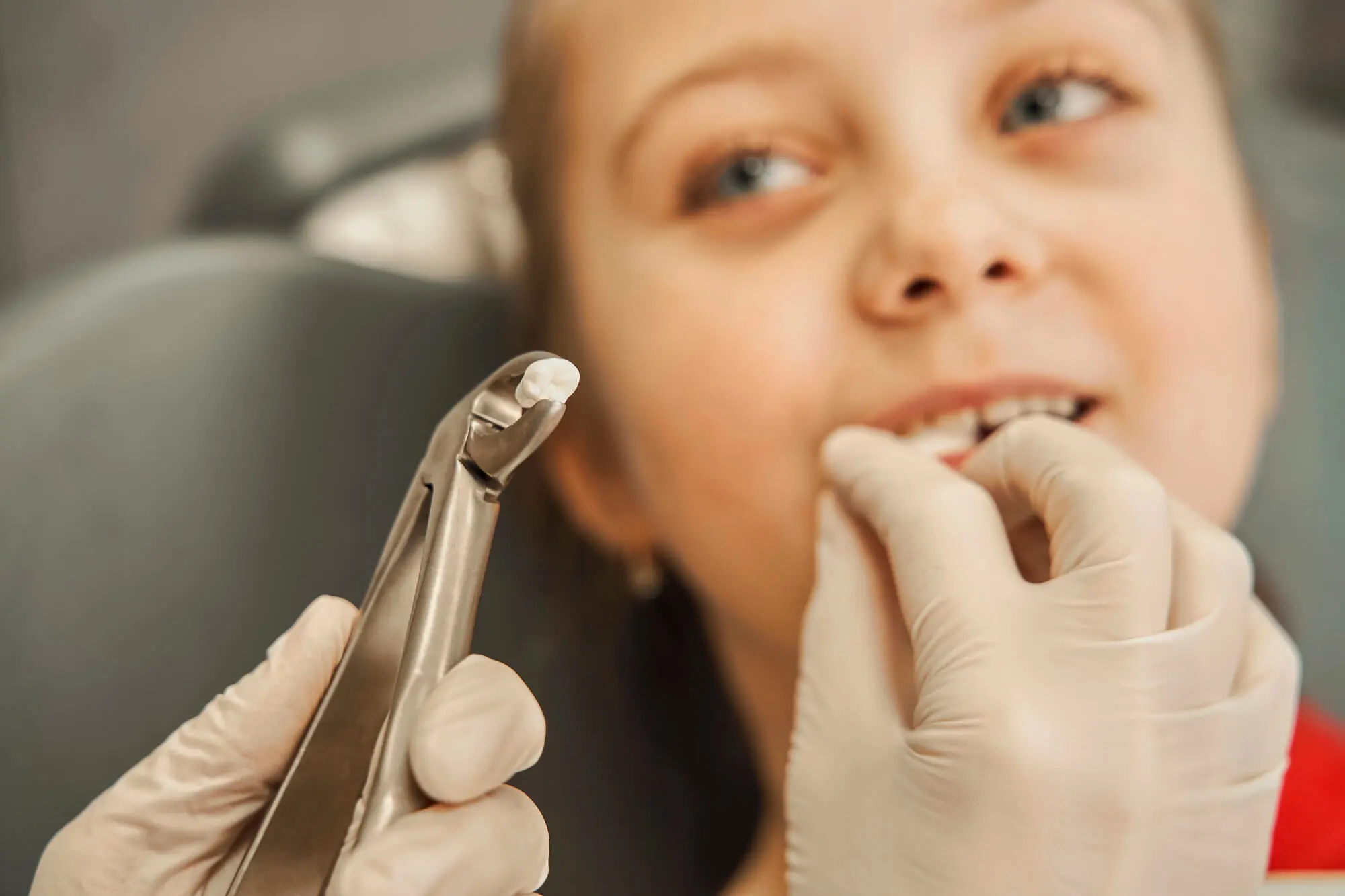 Dentist in Fort Piece for Teeth Extractions