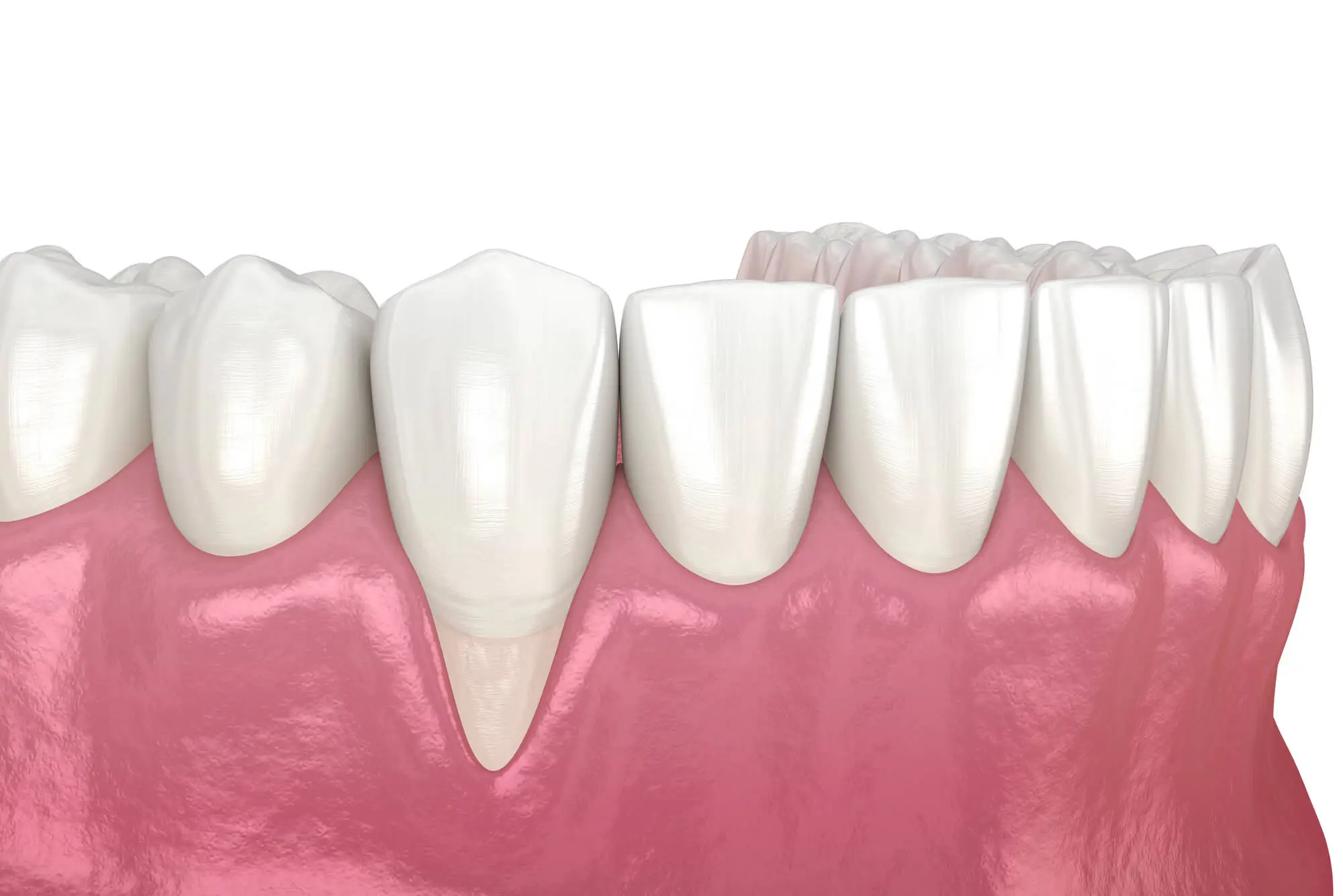 Fort Piece Dentist Explains Why Teeth Don't Grow Larger