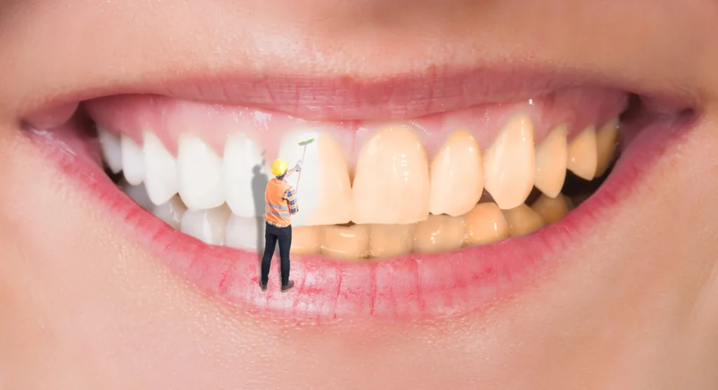 Creative concept of whitening teeth, teeth whitening in Fort Pierce