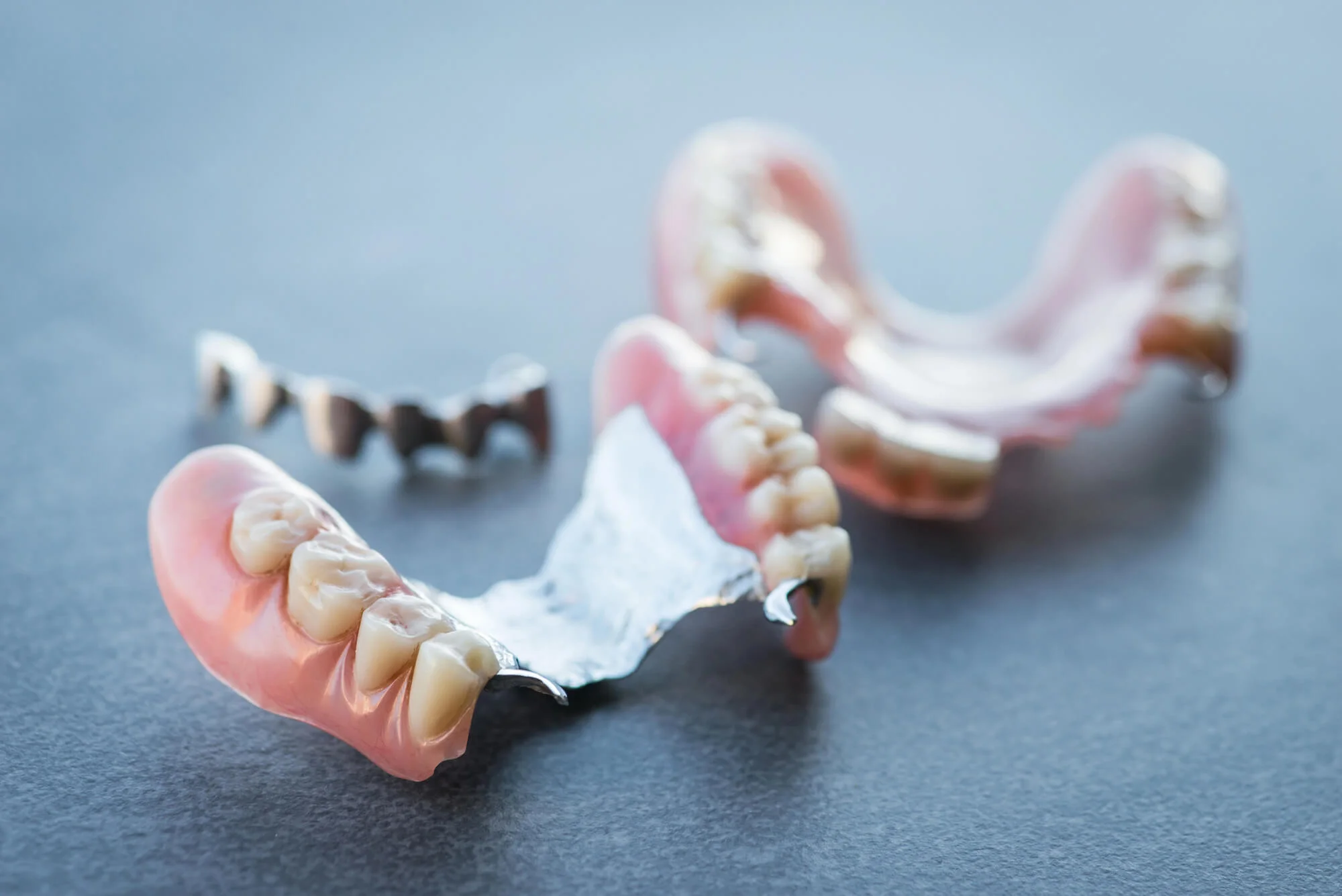 Metal framework partial dentures on table, dentures in Fort Pierce