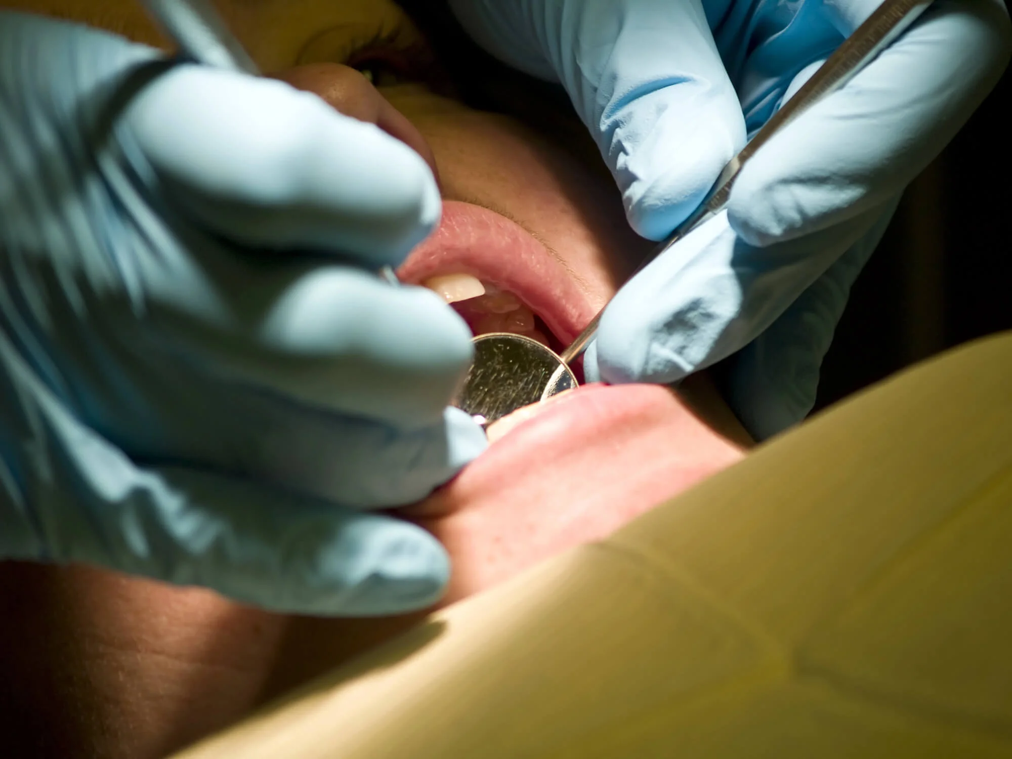 Dental surgery close-up procedure best dentist in Fort Pierce