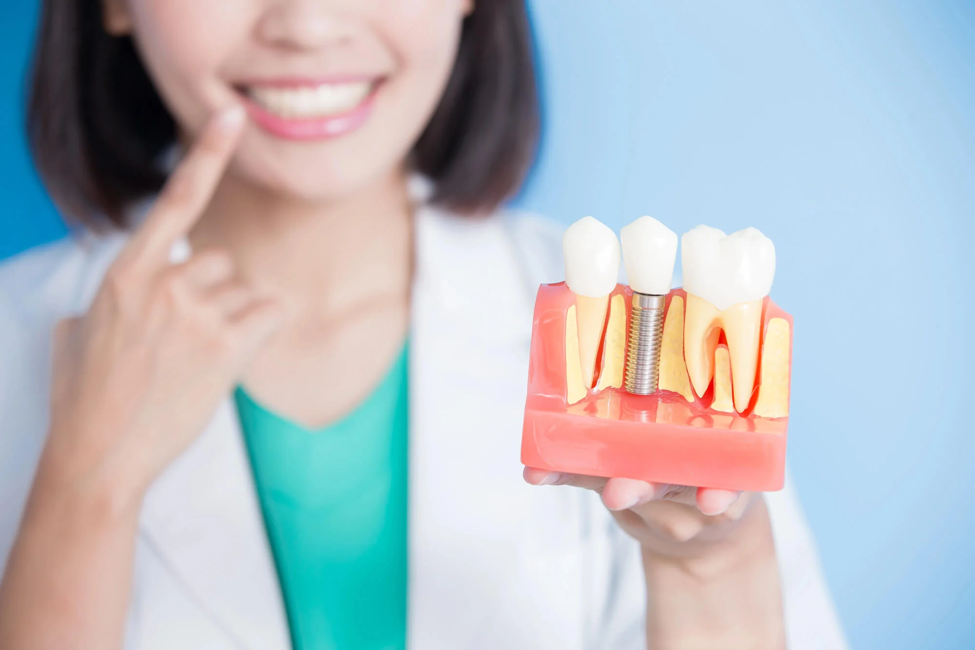 Dentist holding implant model dental implants in Port St. Lucie