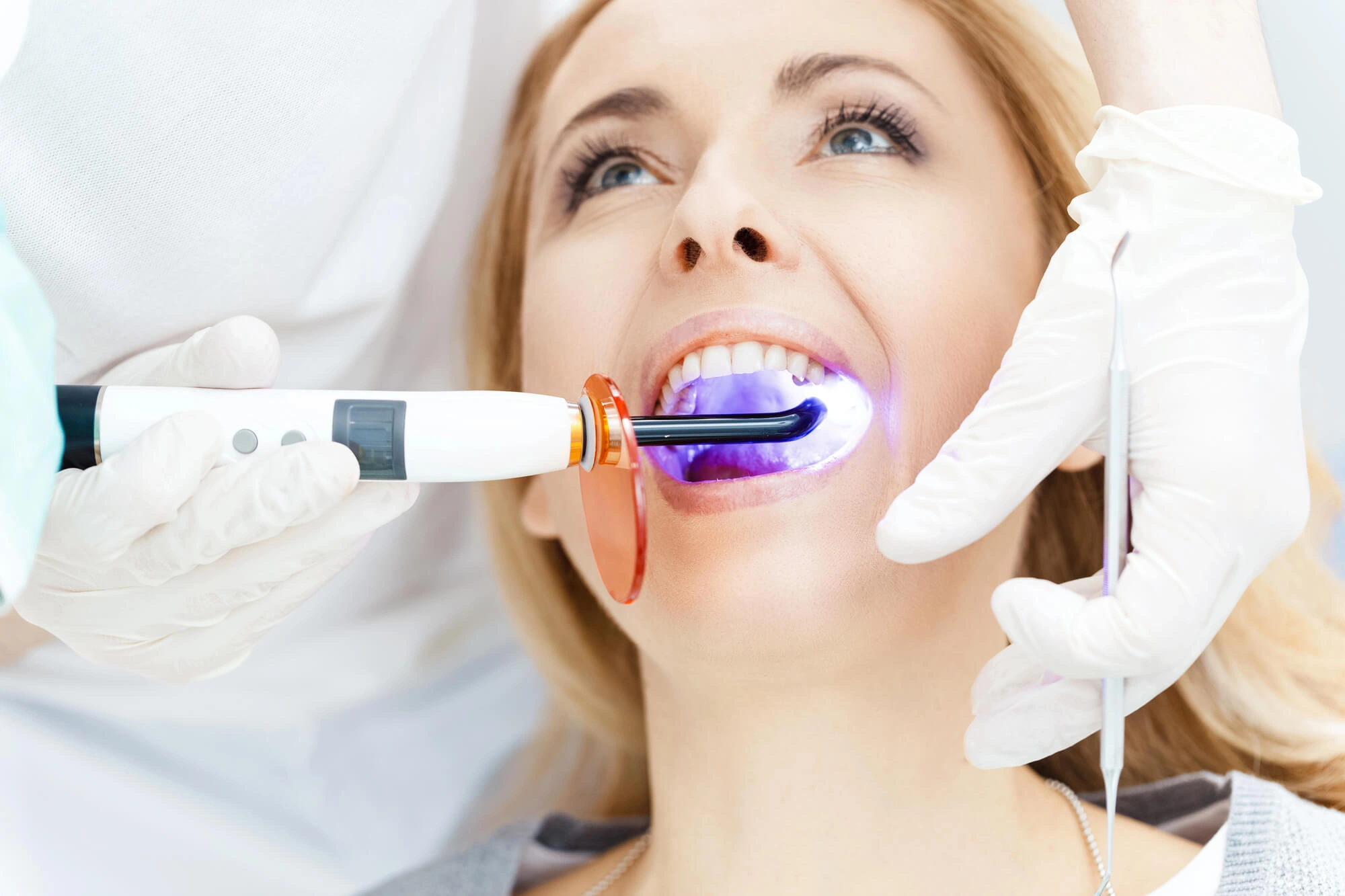Teeth Whitening by Fort Pierce Dentist